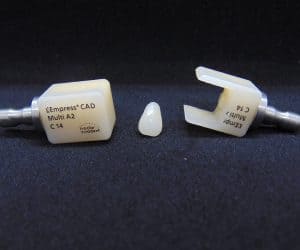 Медентис имплантация зубов цифровая стоматология